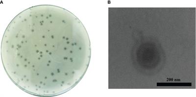Characterization and efficacy against carbapenem-resistant Acinetobacter baumannii of a novel Friunavirus phage from sewage